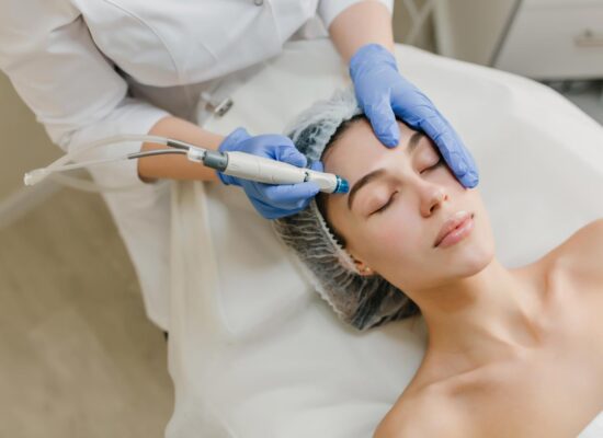 Microneedling